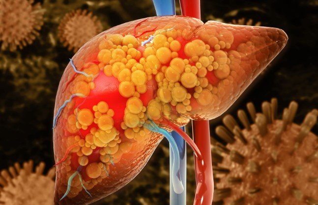 weight loss medications