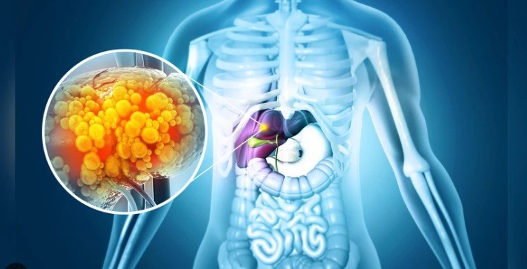 weight loss medications